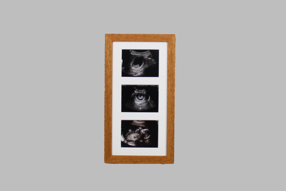Baby Scan Photo Frame - Multi aperture Frame for Three Scan sized Photos. Handmade. Baby Shower Gift | Pregnancy Announcement