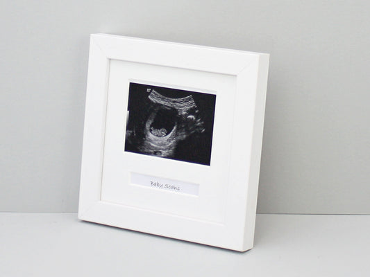 Preserving Precious Beginnings: Why You Should Frame Your Baby Scan