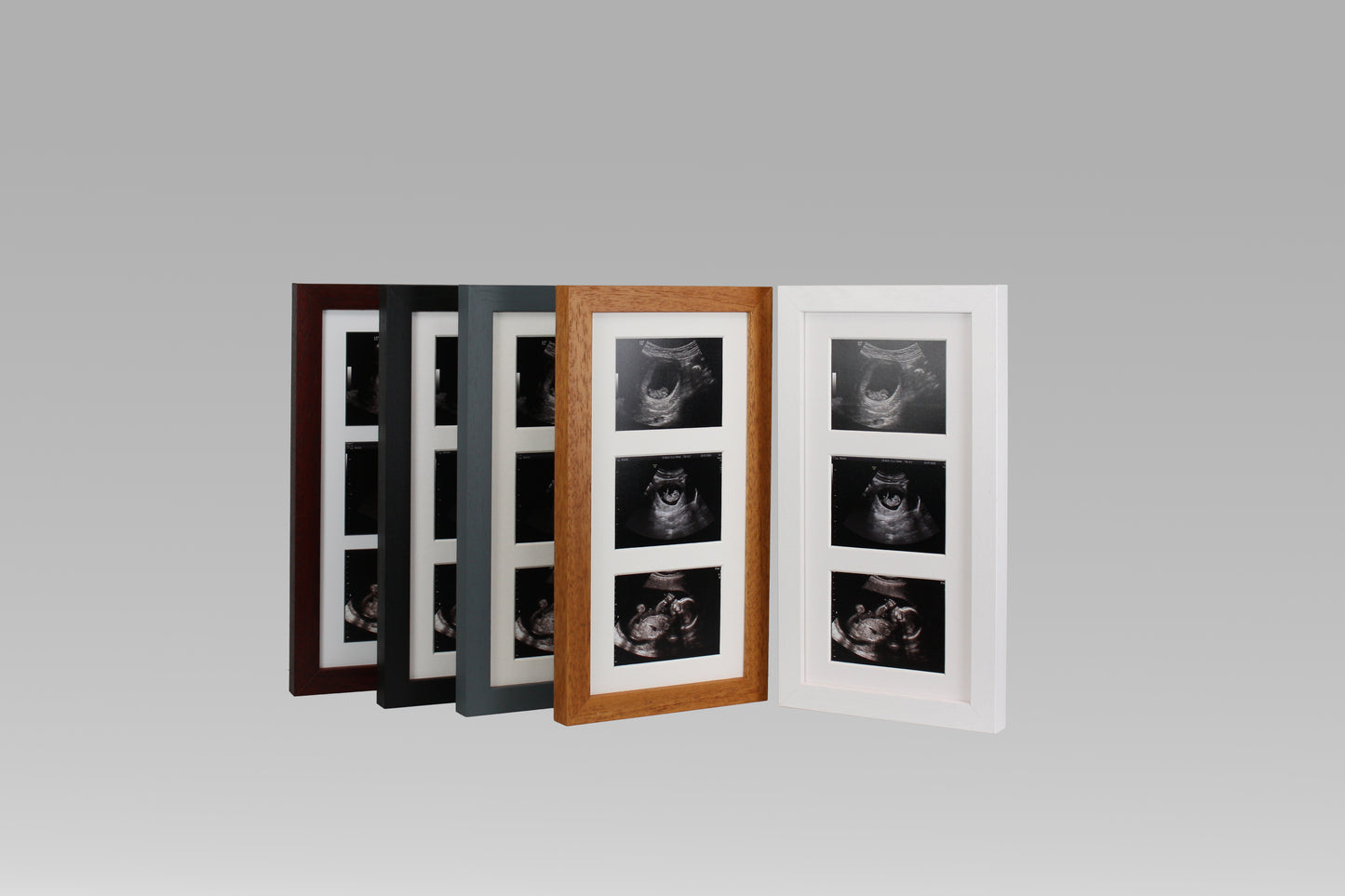 Baby Scan Photo Frame - Multi aperture Frame for Three Scan sized Photos.  Handmade. Baby Shower Gift | Pregnancy Announcement