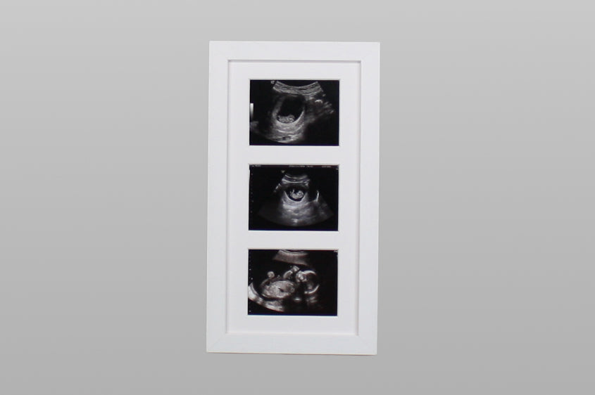 Baby Scan Photo Frame - Multi aperture Frame for Three Scan sized Photos.  Handmade. Baby Shower Gift | Pregnancy Announcement