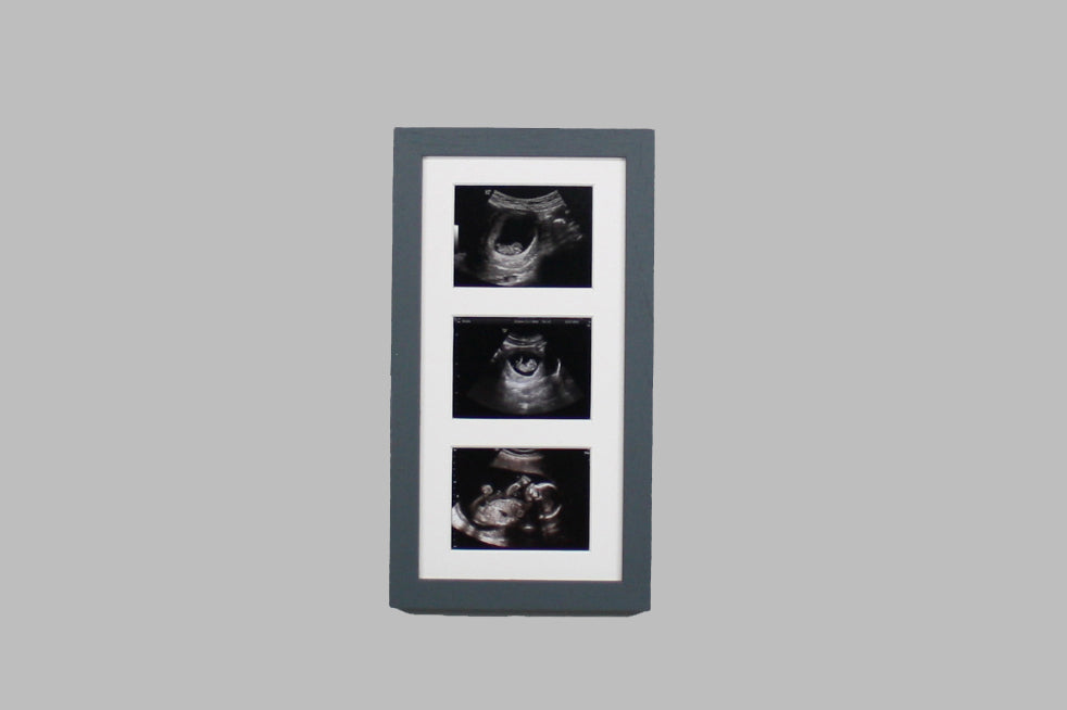 Baby Scan Photo Frame - Multi aperture Frame for Three Scan sized Photos.  Handmade. Baby Shower Gift | Pregnancy Announcement