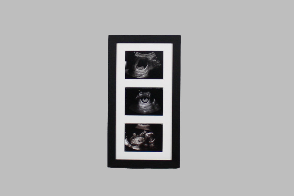 Baby Scan Photo Frame - Multi aperture Frame for Three Scan sized Photos.  Handmade. Baby Shower Gift | Pregnancy Announcement