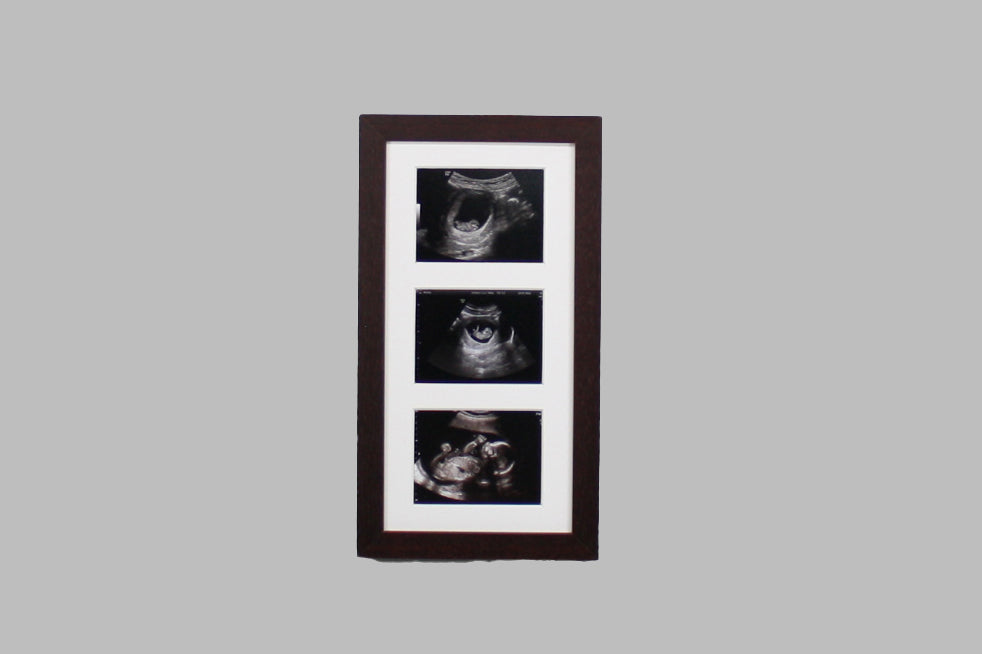 Baby Scan Photo Frame - Multi aperture Frame for Three Scan sized Photos.  Handmade. Baby Shower Gift | Pregnancy Announcement