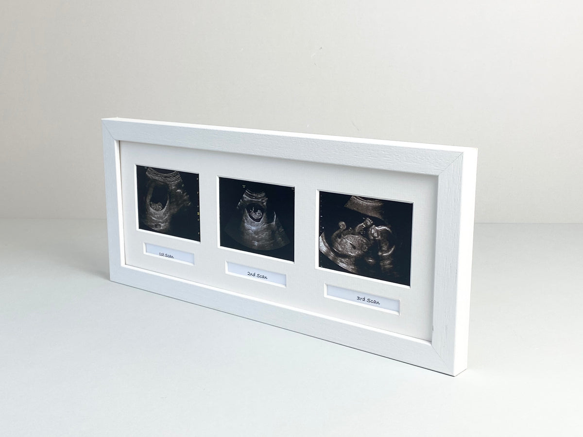 Scan Frame Baby Ultrasound Frame