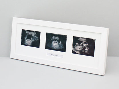 White Frame with three sonogram sized apertures for Baby Scans, with text box.