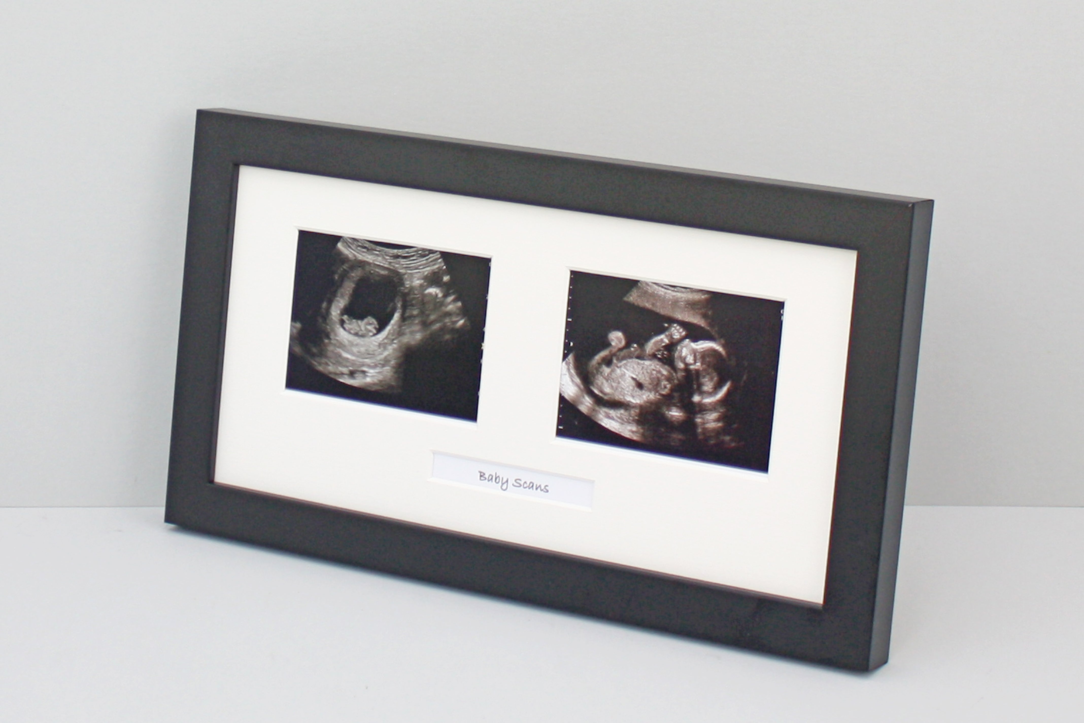 Baby Scan Frame | Frames designed to Display your ultrasound ...