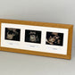 Landscape Baby Scan frame. Suits three Scans and three Text Boxes. Optional Personalisation